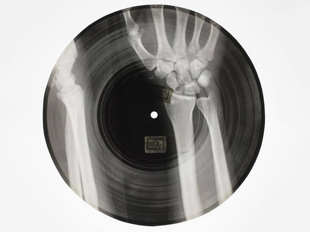 X-Ray audio and bone music